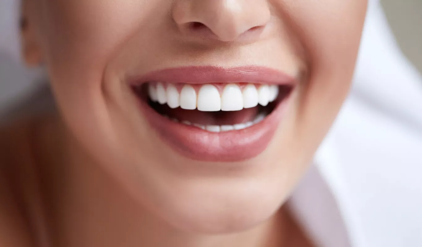 Newport Beach Smile Makeover