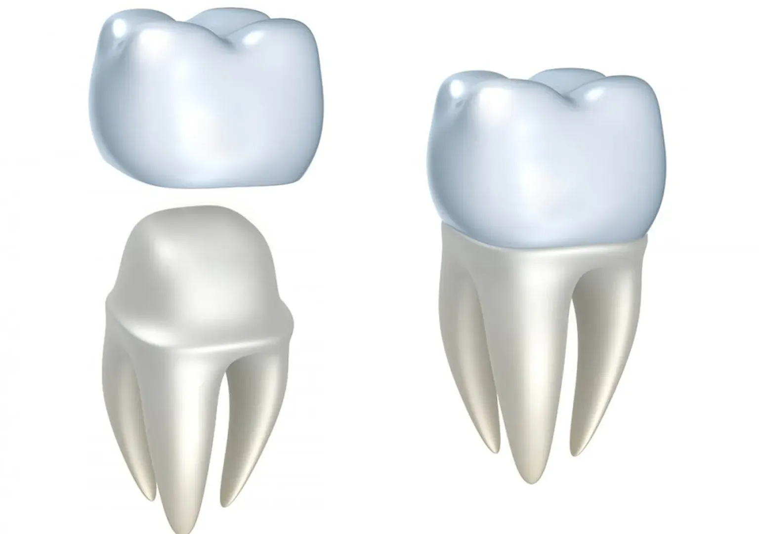 How Porcelain Crowns In Newport Beach, California Can Rejuvenate Your Appearance And Teeth Function