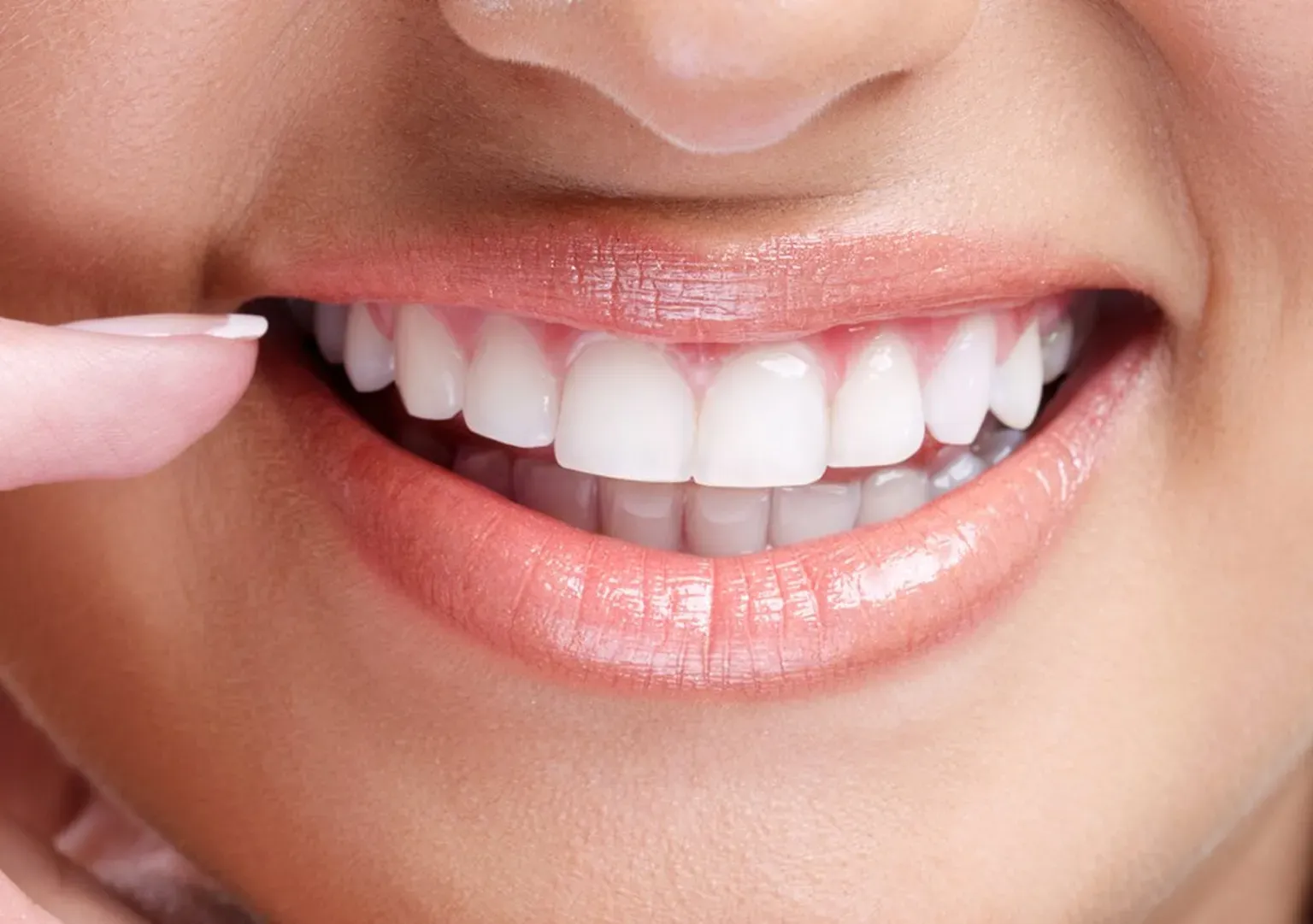 Revitalize Your Smile: Newport's Teeth Whitening Magic!