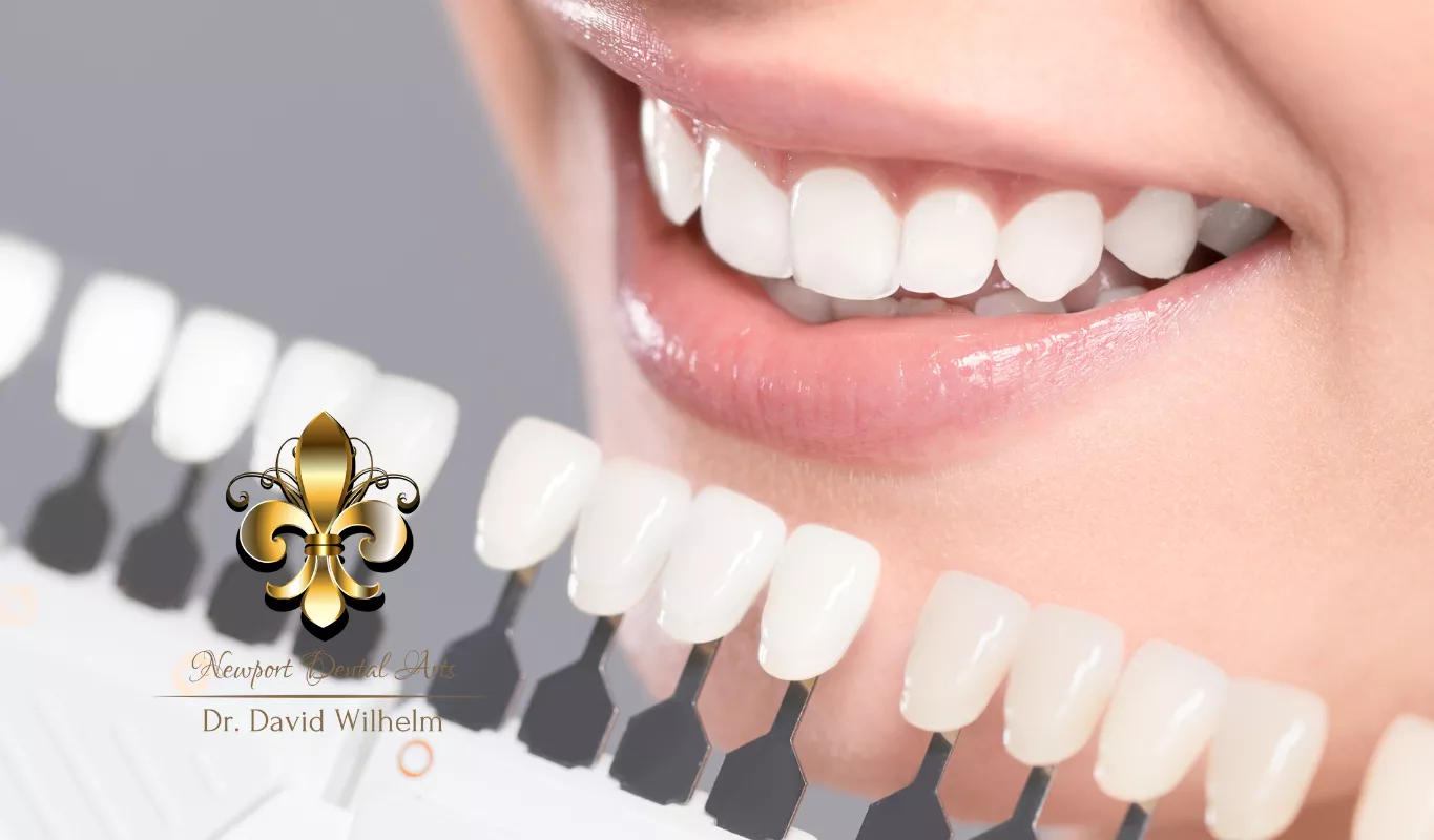 5 Essential Facts About Teeth Whitening