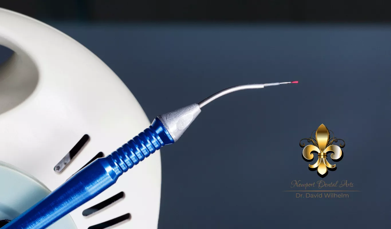 5 Precision Perks of Laser Dentistry