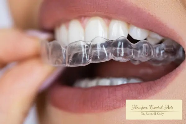 Invisalign treatment newport beach dentist