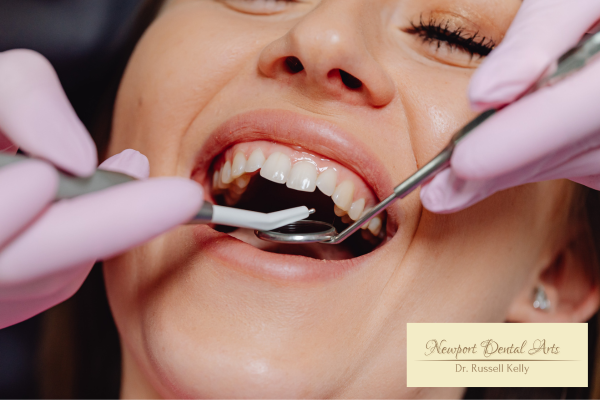 Newport Dental Arts hygienist using digital intraoral scanner for preventive dental exam in Newport Beach