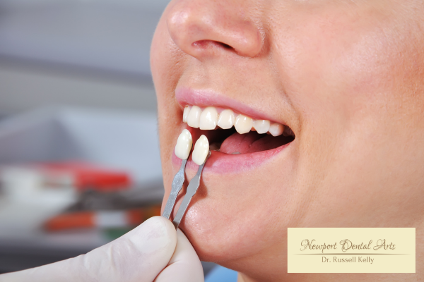 close-up illustration of ultra-thin veneer bonded to tooth, before & after, Newport Dental Arts
