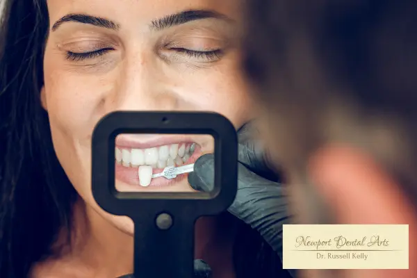 Dr. Russell Kelly applying ultra-thin no-prep veneer as part of minimally invasive cosmetic dentistry at Newport Dental Arts in Newport Beach