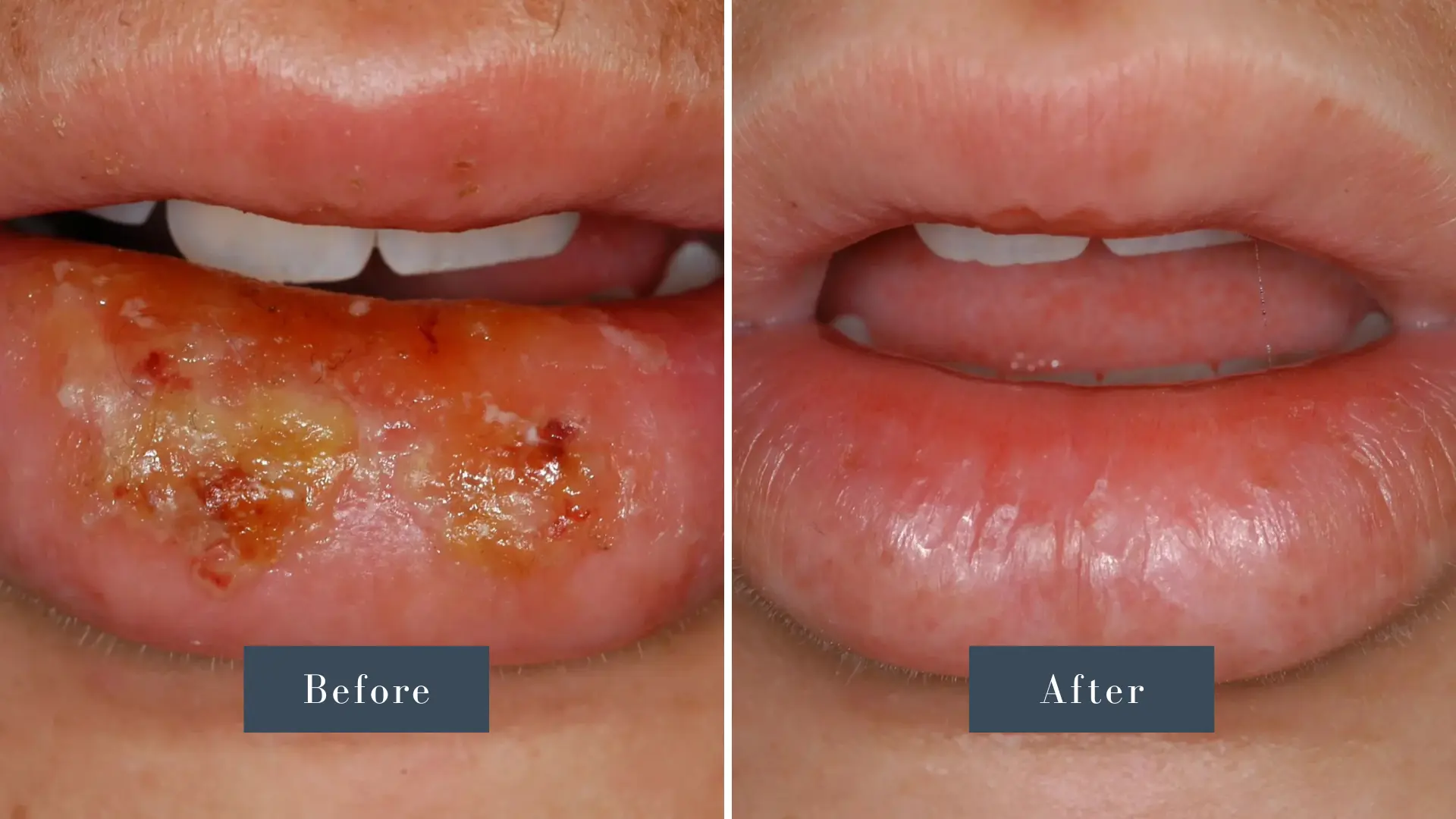 Dr Russell Kelly DDS Newport Dental Arts Laser Dentistry before and after